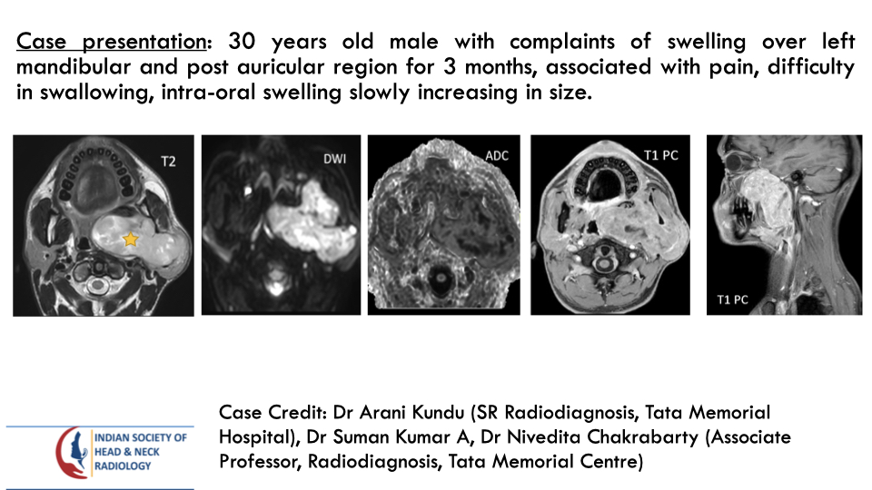 Case 189 — slide 1 of 3
