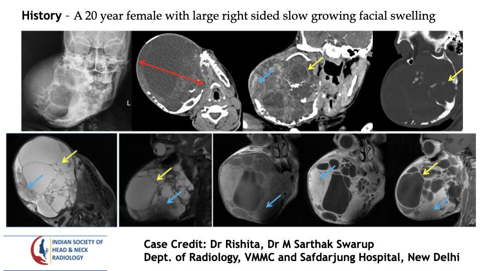 Case 190 — slide 1 of 3