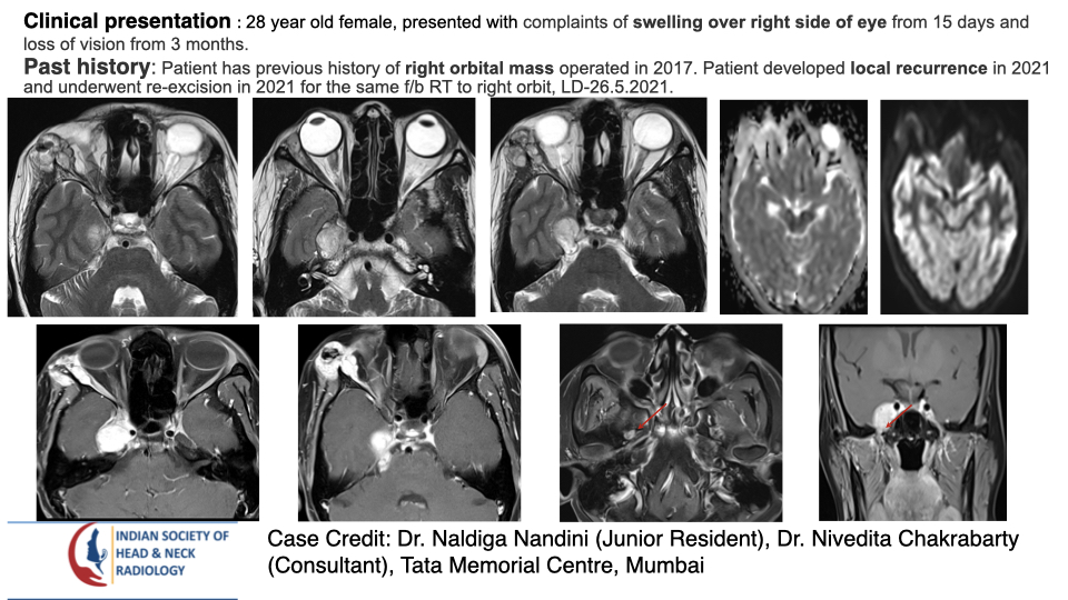Case 191 — slide 1 of 4