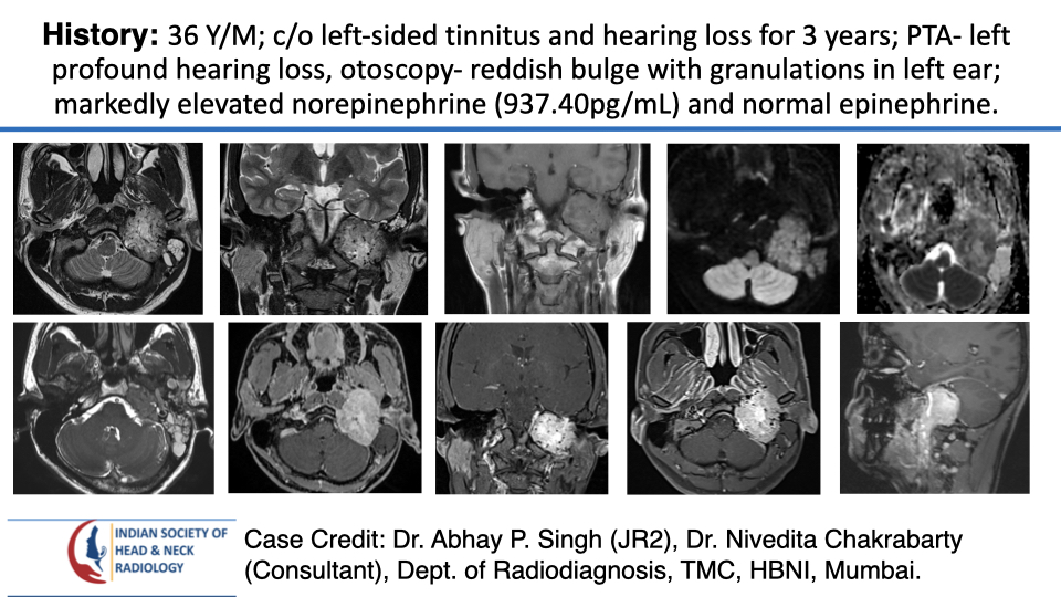 Case 193