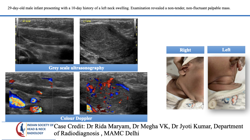 Case 194