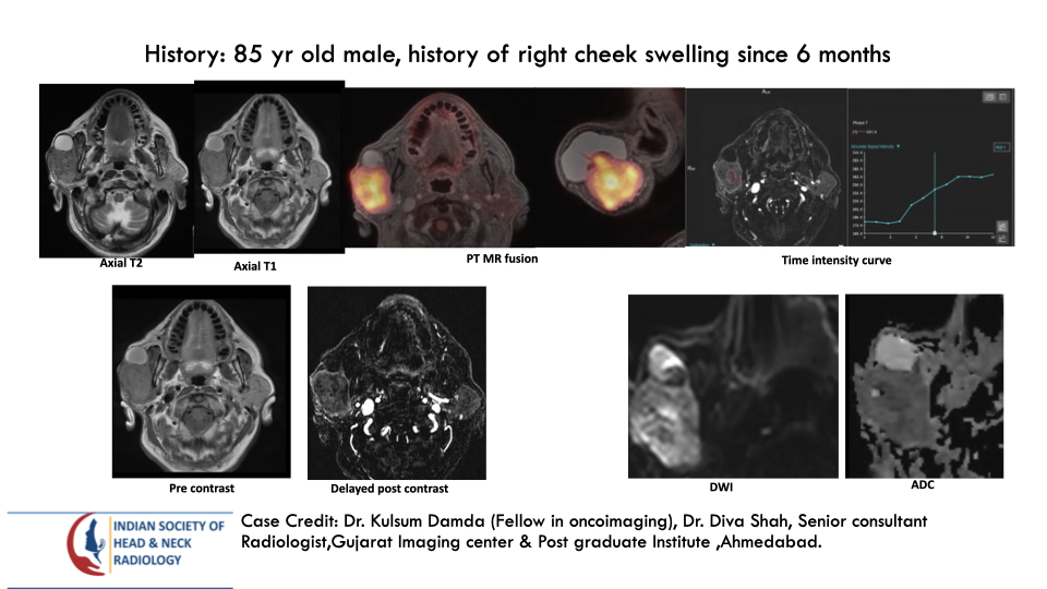 Case 195 — slide 1 of 3