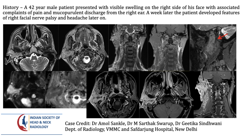 Case 196