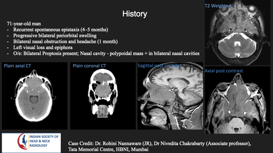 Case 199 — slide 1 of 3