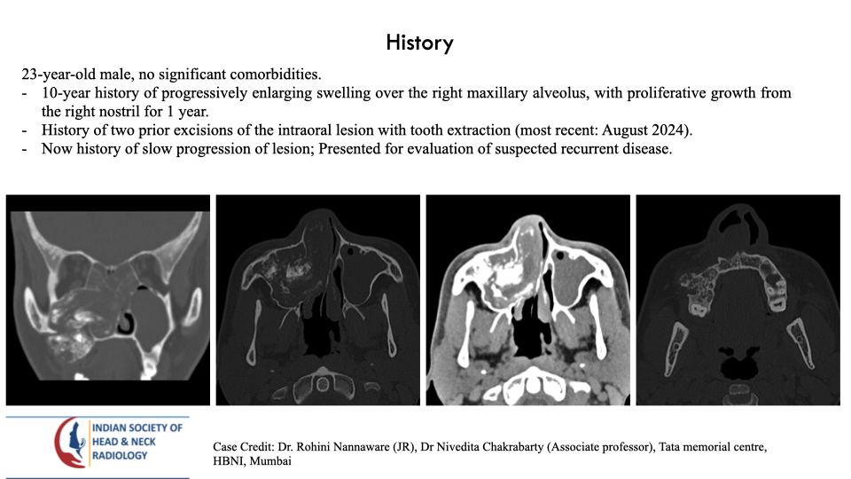 Case 200 — slide 1 of 4