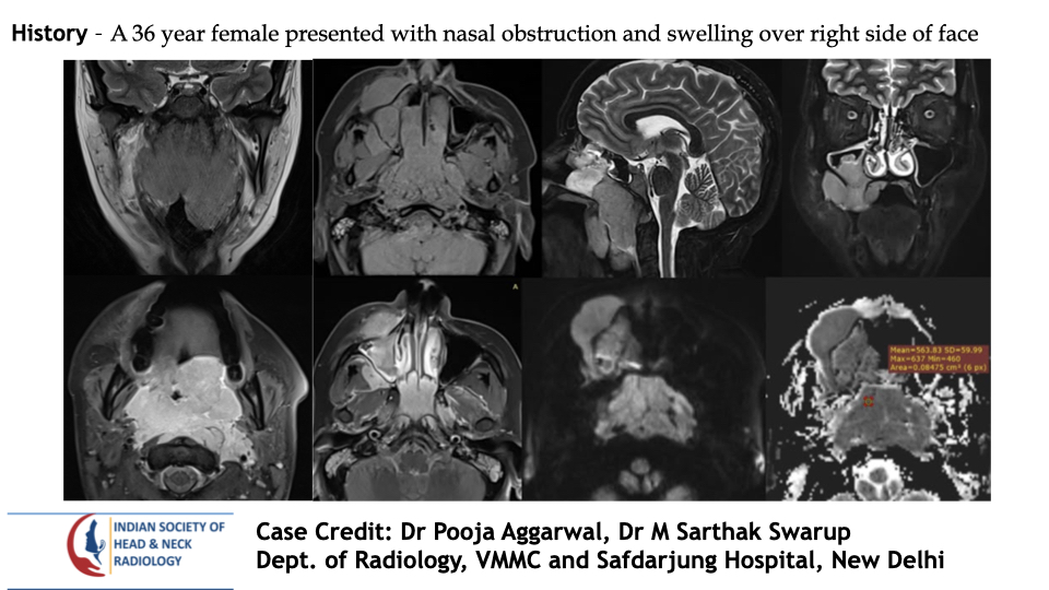 Case 201